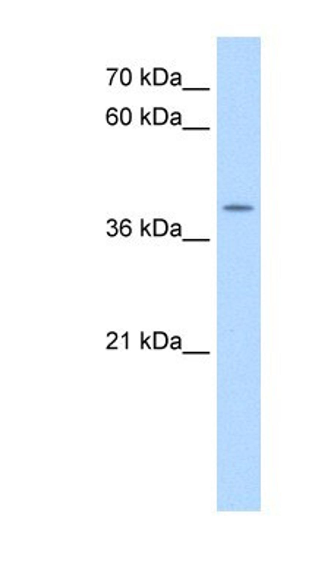 Western Blot: APOBEC3B Antibody [NBP1-57516] - HepG2 cell lysate, concentration 0.2-1 ug/ml.