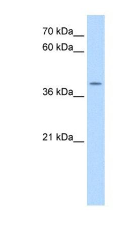 Western Blot: APOBEC3B Antibody [NBP1-57516] - HepG2 cell lysate, concentration 0.2-1 ug/ml.