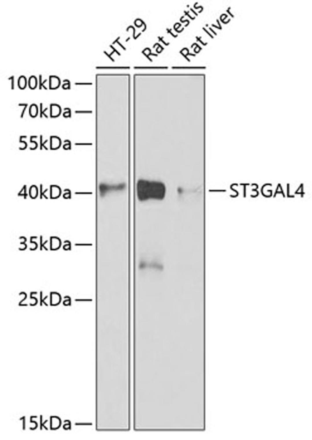 Western blot - ST3GAL4 antibody (A6309)