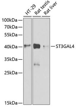 Western blot - ST3GAL4 antibody (A6309)