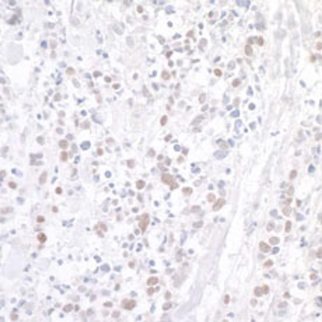 Detection of human WDR79 by immunohistochemistry.