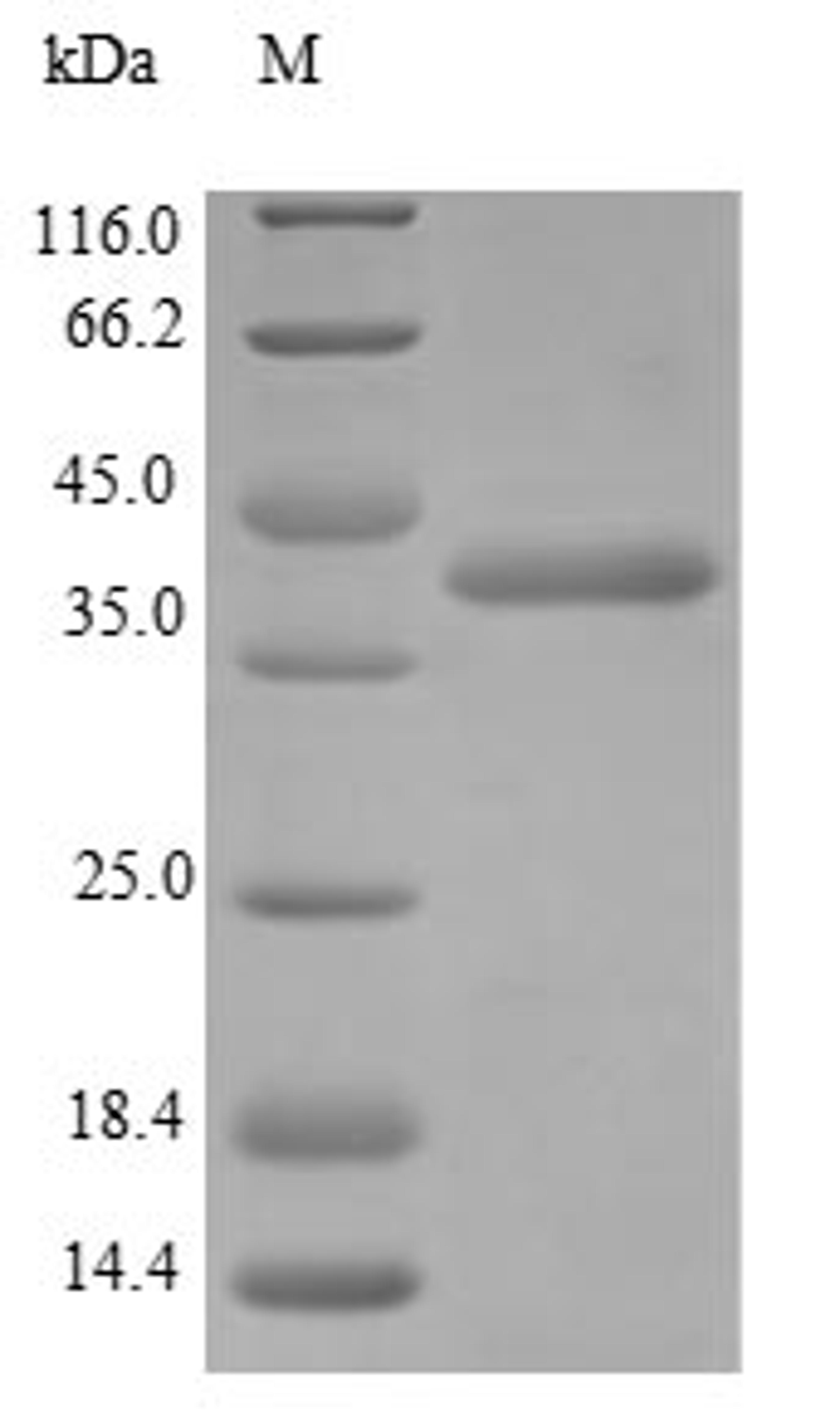 (Tris-Glycine gel) Discontinuous SDS-PAGE (reduced) with 5% enrichment gel and 15% separation gel.