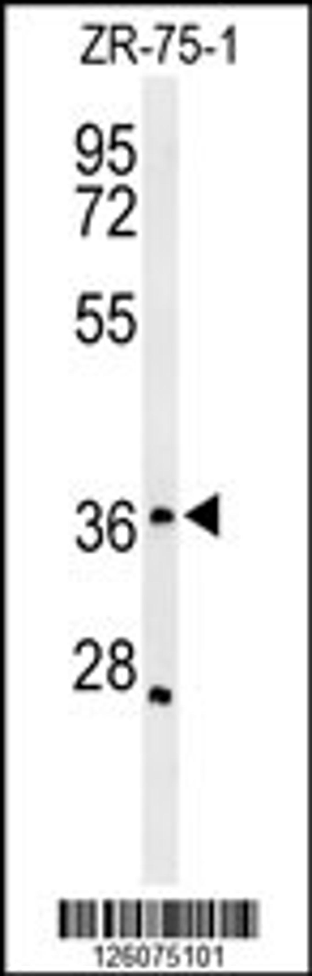 Western blot analysis of MIIP Antibody in ZR-75-1 cell line lysates (35ug/lane)