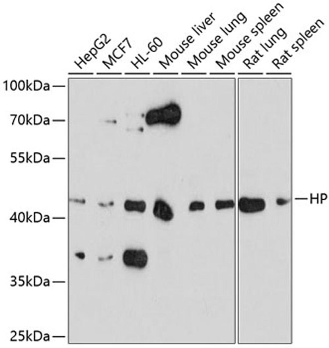 Western blot - HP antibody (A1571)