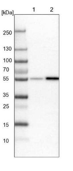 Western Blot: WIRE Antibody [NBP1-86856] - Lane 1: NIH-3T3 cell lysate (Mouse embryonic fibroblast cells)<br/>Lane 2: NBT-II cell lysate (Rat Wistar bladder tumour cells)