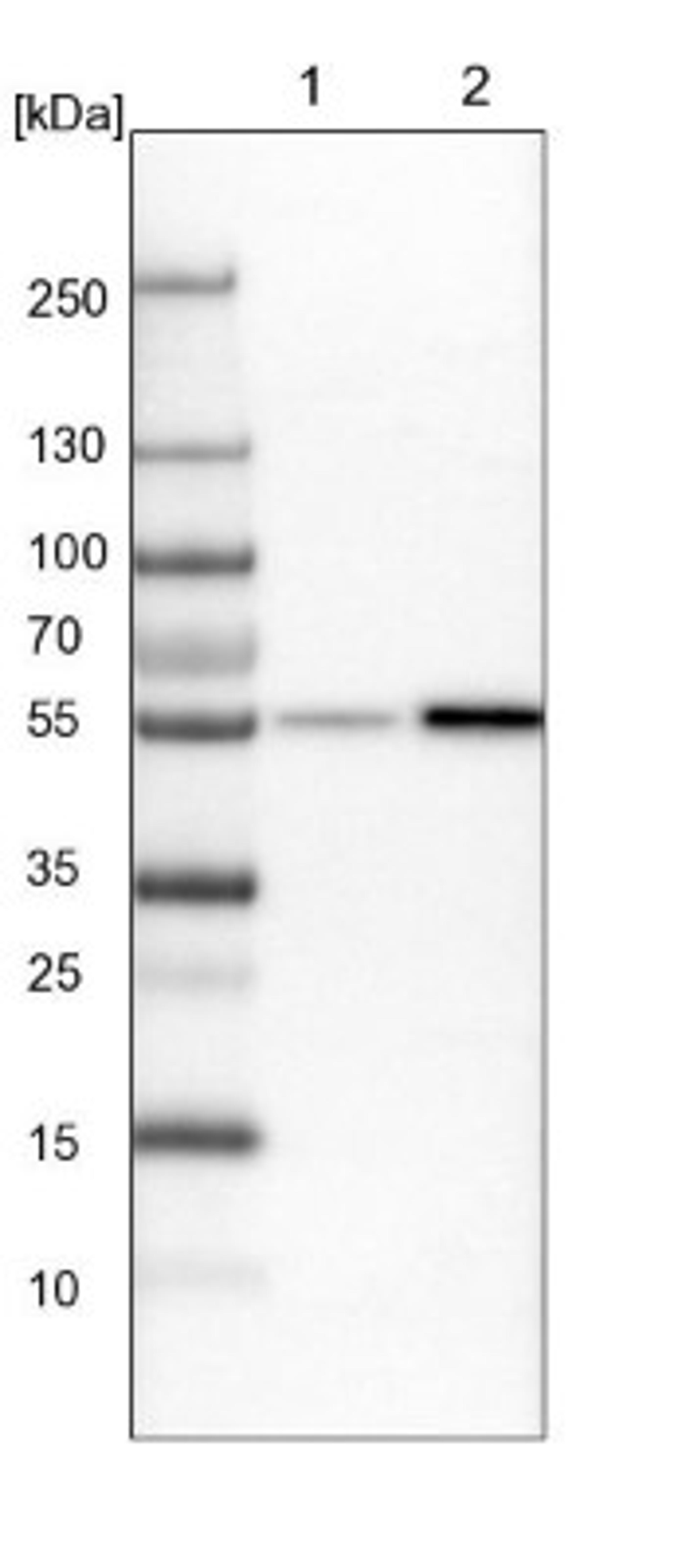 Western Blot: WIRE Antibody [NBP1-86856] - Lane 1: NIH-3T3 cell lysate (Mouse embryonic fibroblast cells)<br/>Lane 2: NBT-II cell lysate (Rat Wistar bladder tumour cells)