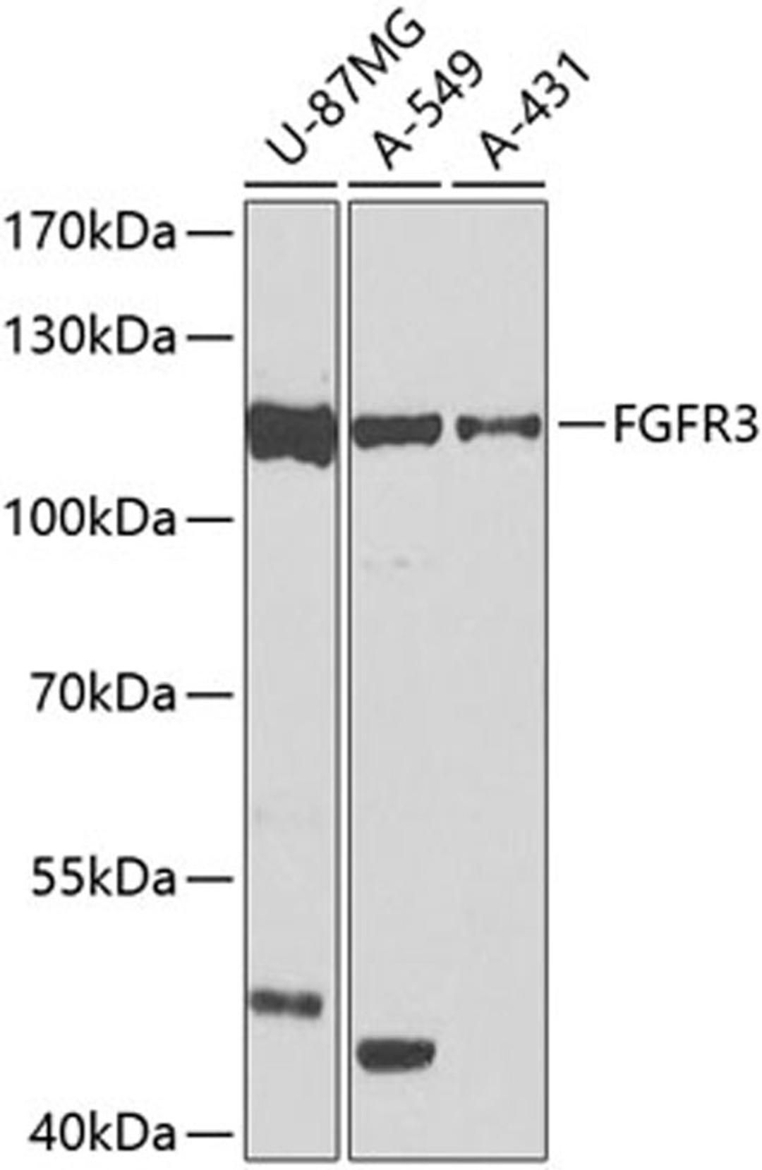 Western blot - FGFR3 antibody (A0404)