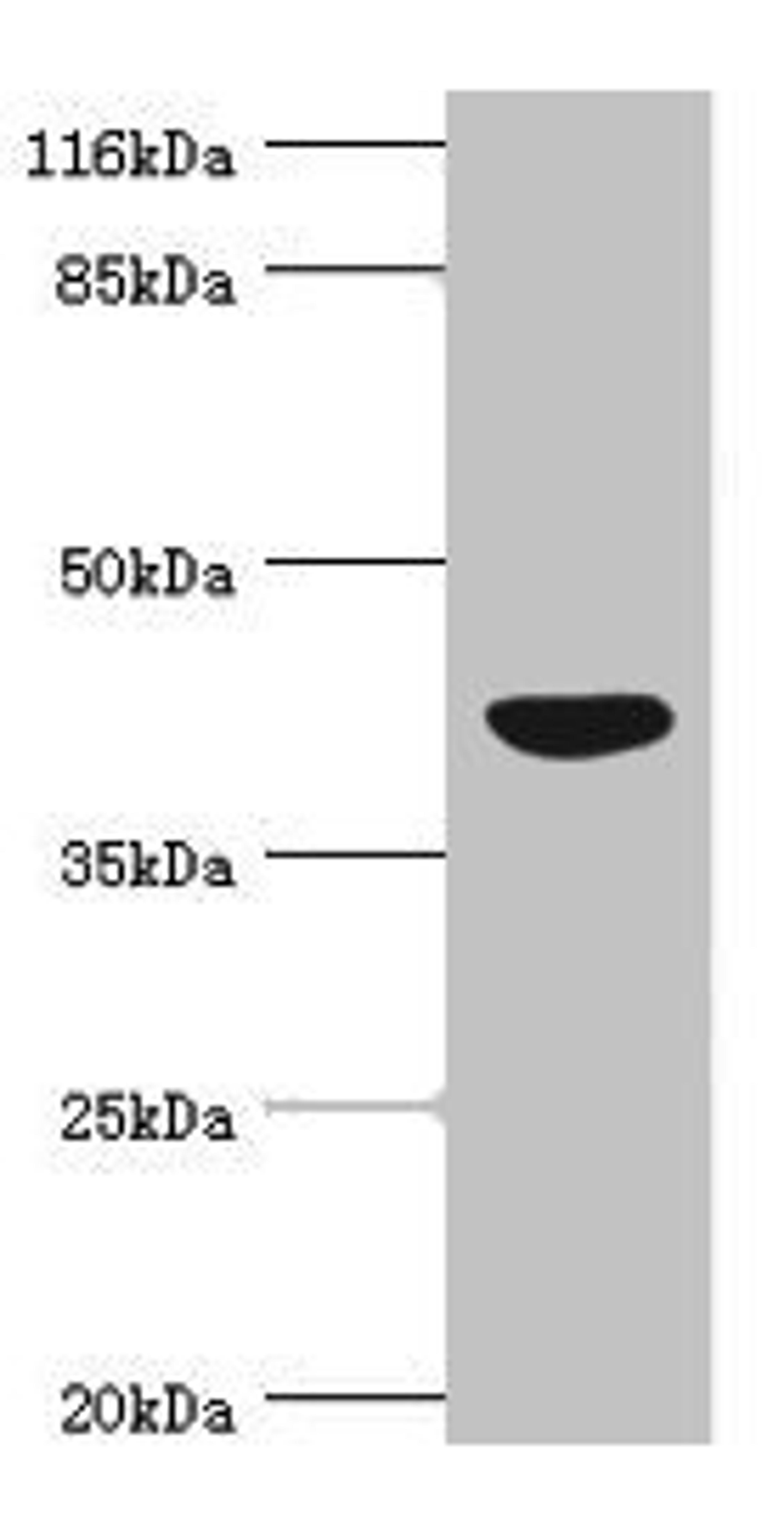 Western blot. All lanes: NDRG2 antibody at 4.02ug/ml + Mouse kidney tissue. Secondary. Goat polyclonal to rabbit IgG at 1/10000 dilution. Predicted band size: 41, 40, 37, 38 kDa. Observed band size: 41 kDa.