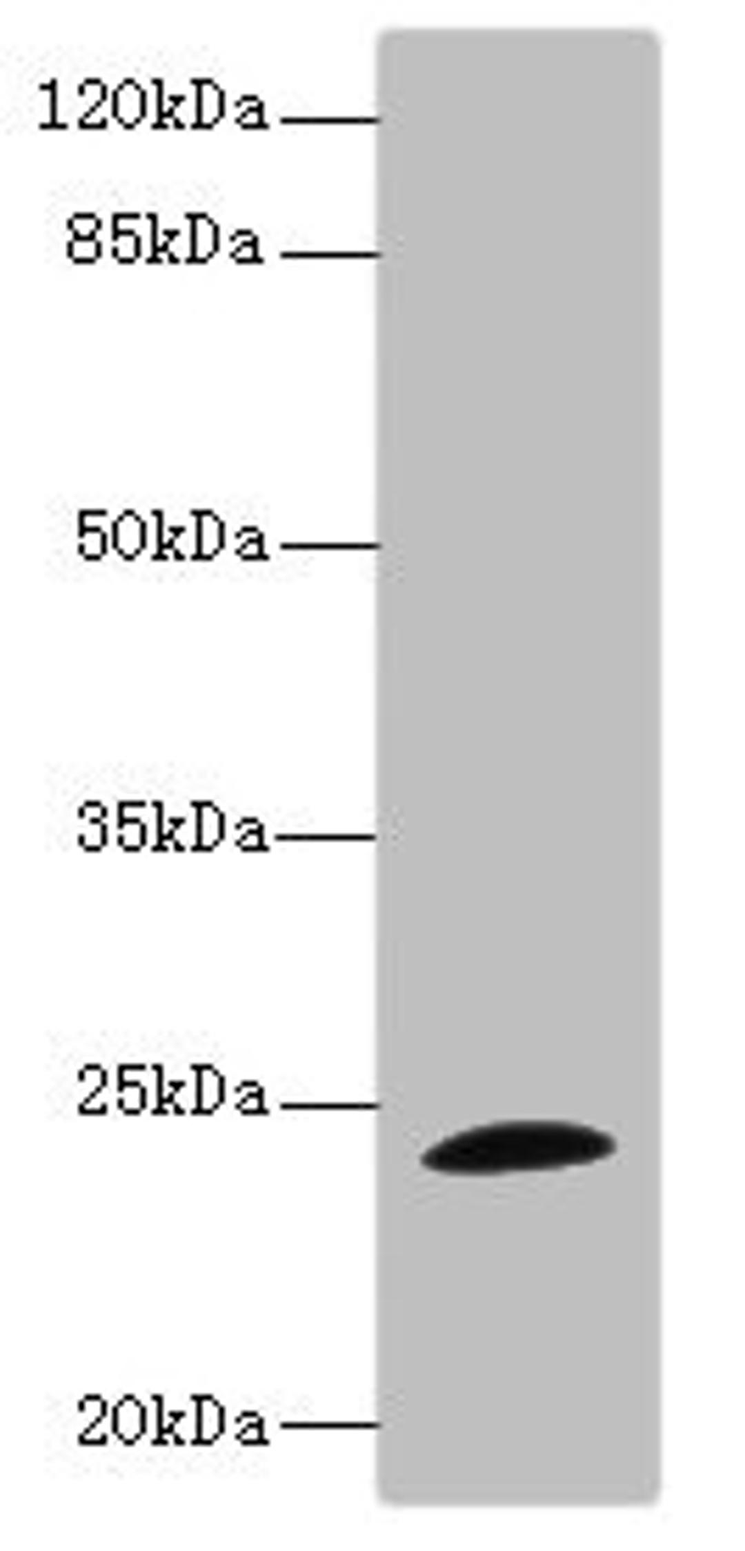 Western blot. All lanes: TPPP antibody IgG at 1.71ug/ml + Mouse brain tissue. Secondary. Goat polyclonal to rabbit IgG at 1/10000 dilution. Predicted band size: 24 kDa. Observed band size: 24 kDa.
