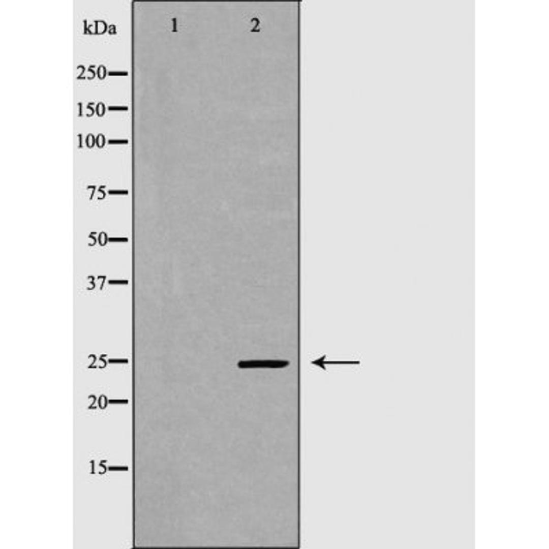 Western blot analysis of testis cell and livercell lysate using GPX5 antibody