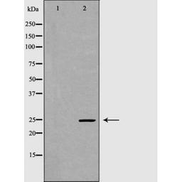 Western blot analysis of testis cell and livercell lysate using GPX5 antibody