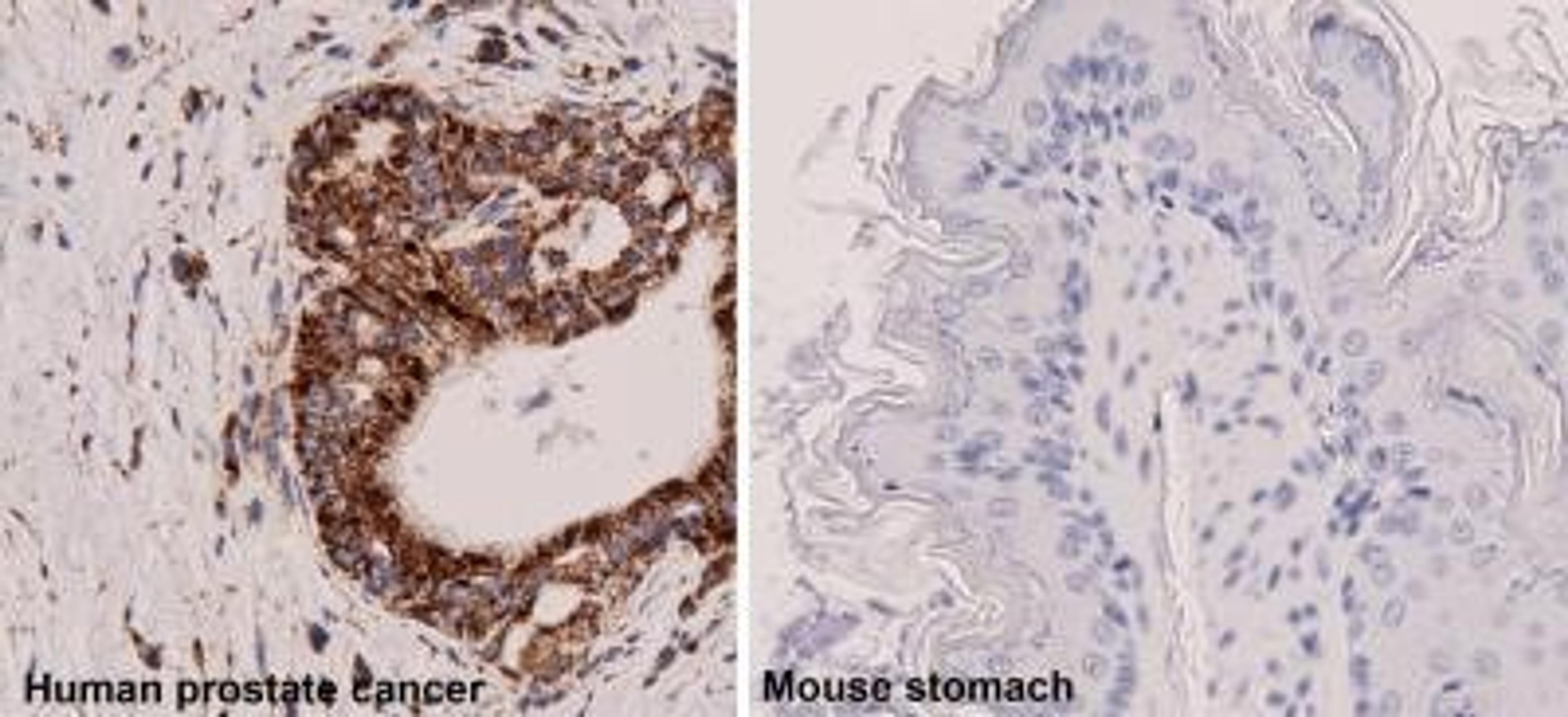 Immunohistochemistry-Paraffin: Mitochondria Antibody (113-1) [NBP2-32980] - Analysis using the Biotin conjugate of NBP2-32980. Staining of human prostate cancer tissue (left) and mouse stomach tissue (right). Image from verified customer review.