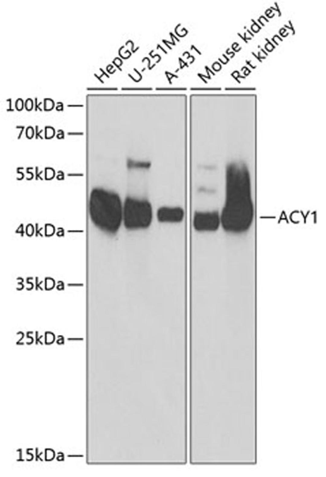 Western blot - ACY1 antibody (A13458)