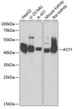 Western blot - ACY1 antibody (A13458)