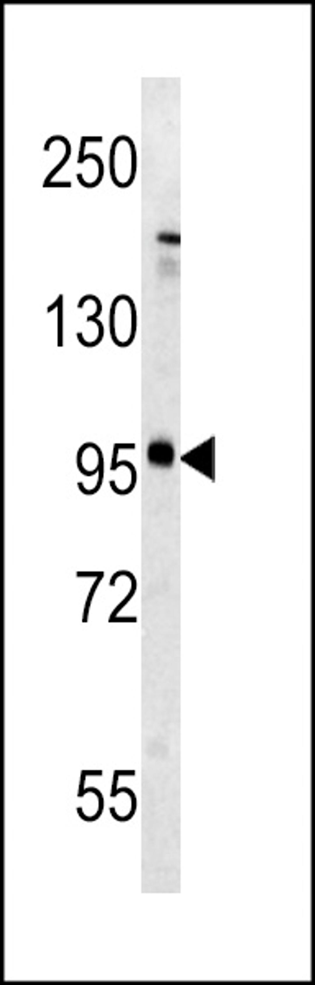 Western blot analysis of Metabotropic Glutamate Receptor 5 (GPRC1E) antibody (C-term T1003) in mouse brain tissue lysates (35ug/lane).