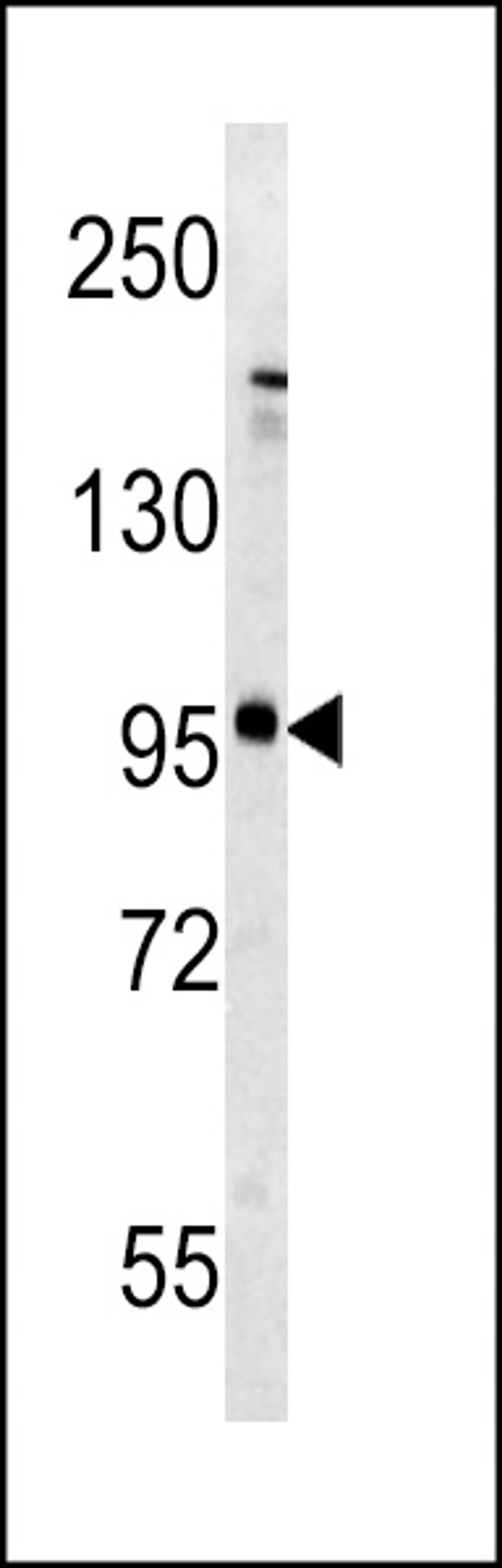 Western blot analysis of Metabotropic Glutamate Receptor 5 (GPRC1E) antibody (C-term T1003) in mouse brain tissue lysates (35ug/lane).