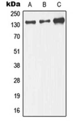 Western blot analysis of IMR32 (Lane 1), mouse brain.rat brain (Lane 2), PC12 (Lane 3) whole cell lysates using MAPK8IP3 antibody