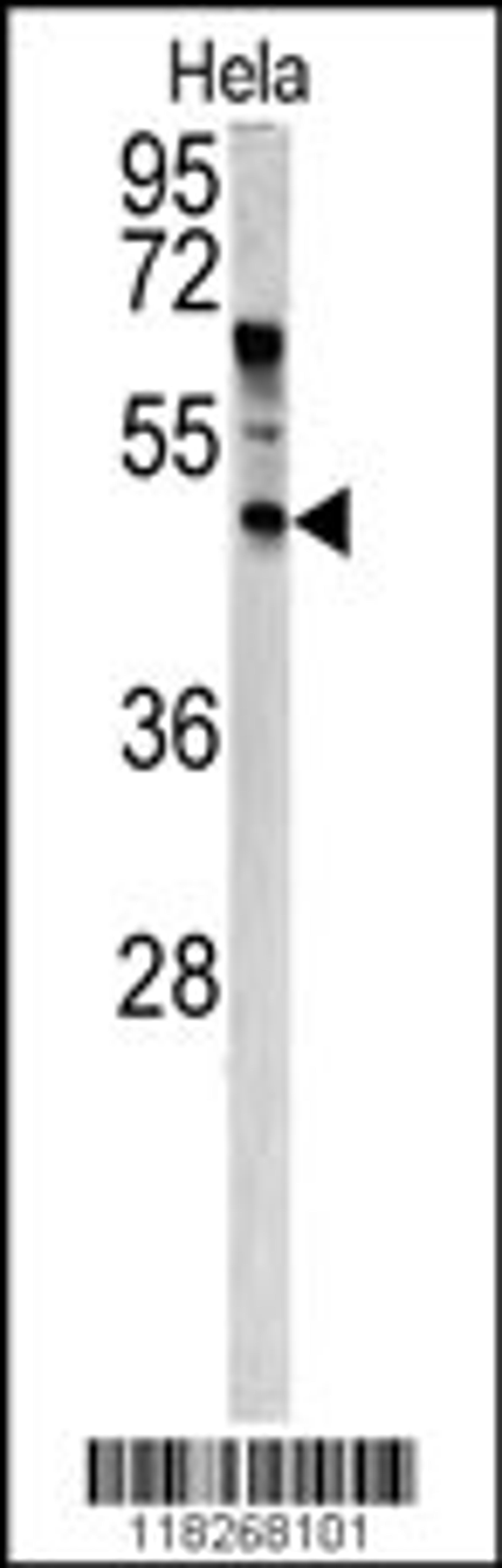 Western blot analysis of ANGPTL7 antibody in Hela cell line lysates (35ug/lane)