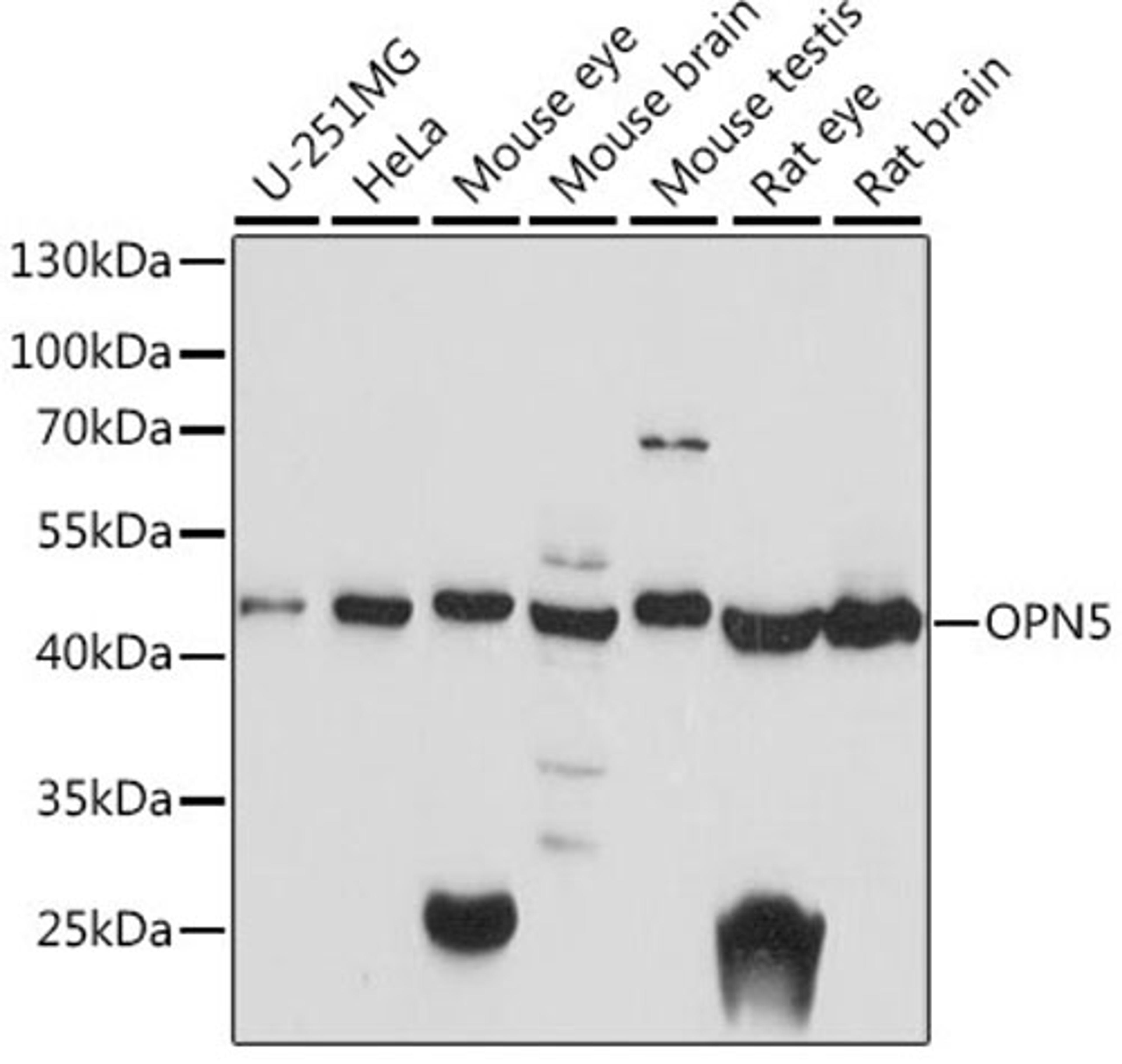 Western blot - OPN5 antibody (A15971)