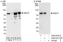 Detection of human SRp75 by western blot and immunoprecipitation.