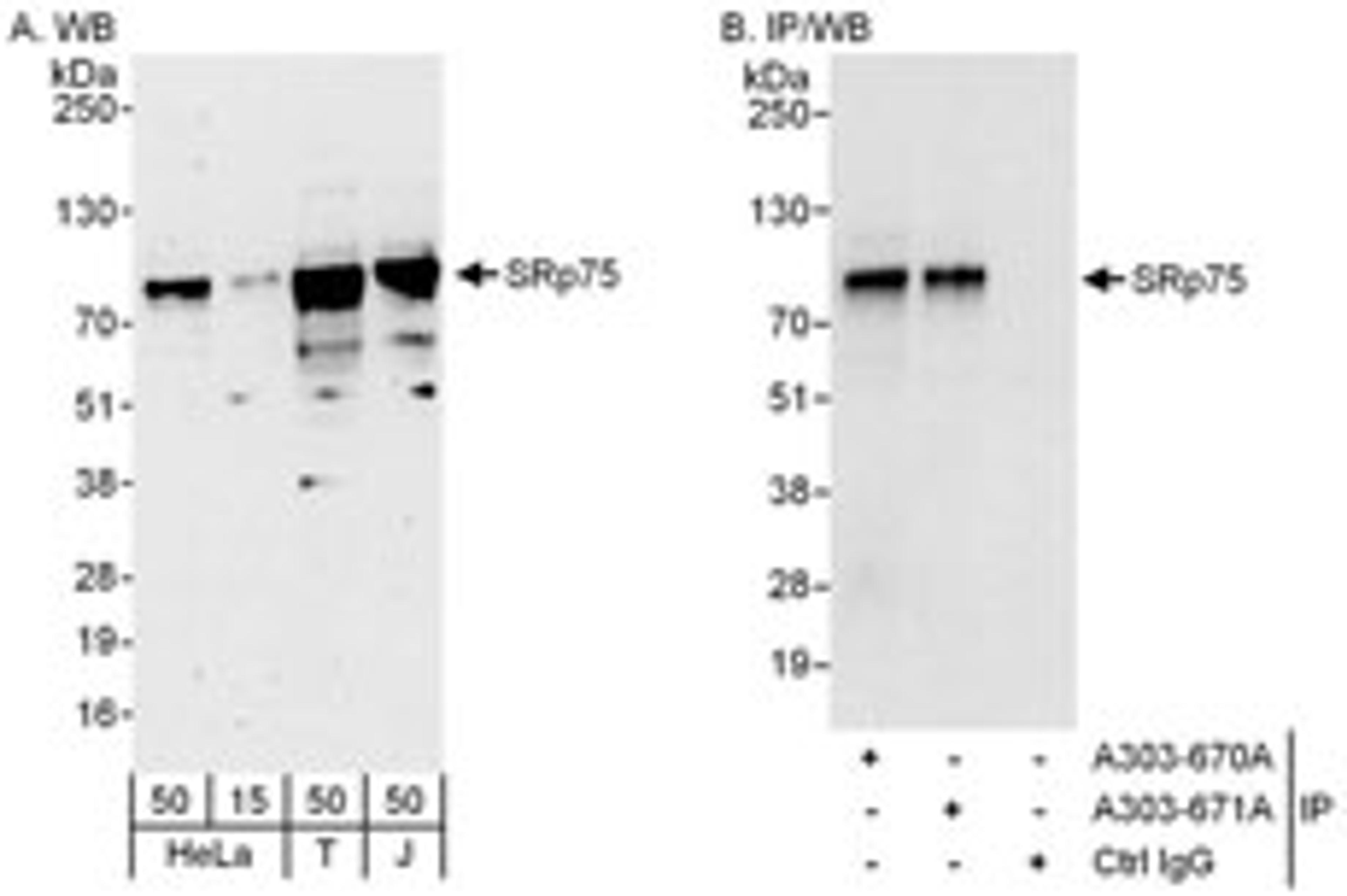 Detection of human SRp75 by western blot and immunoprecipitation.