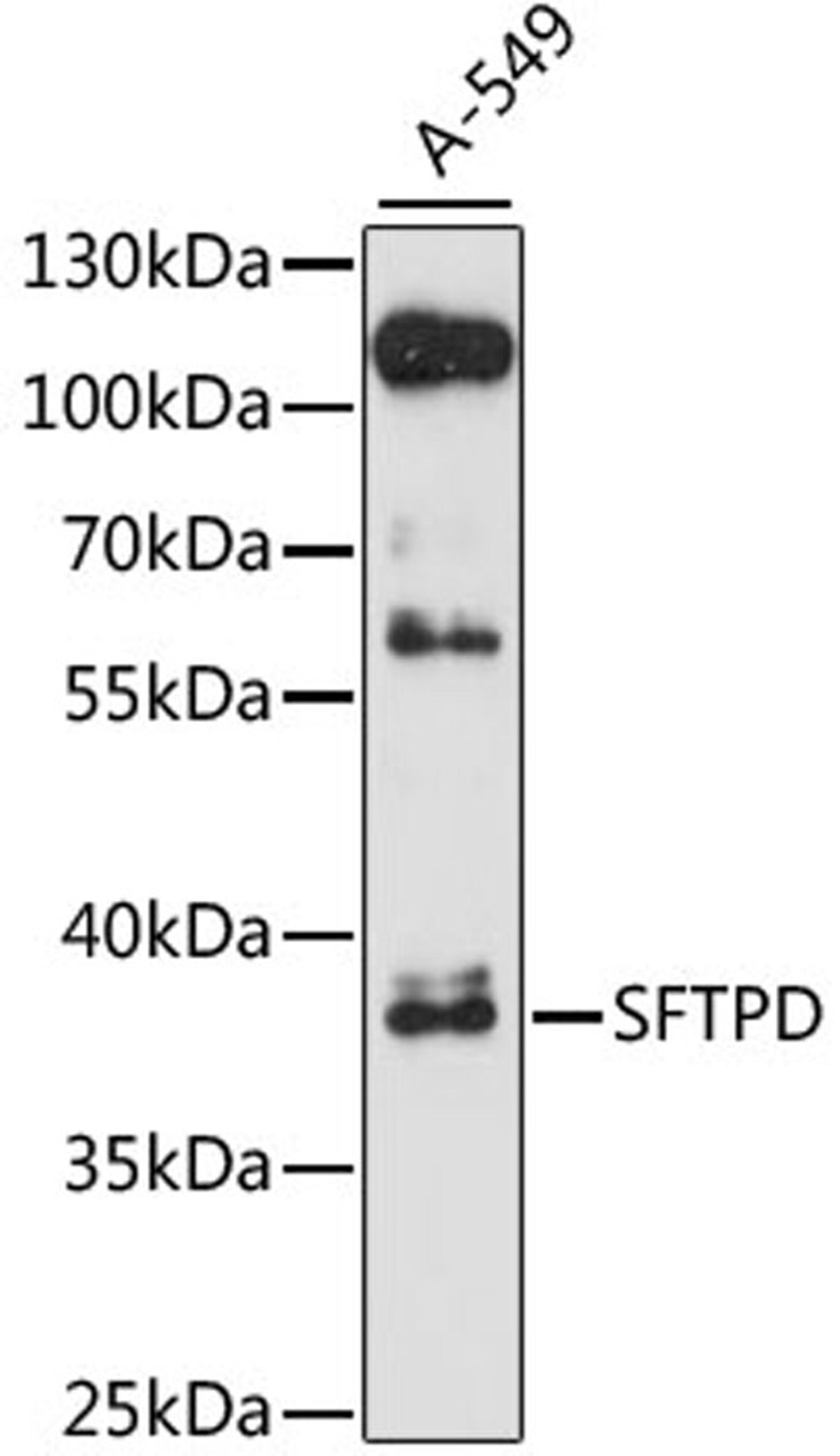 Western blot - SFTPD antibody (A1651)