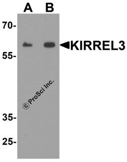 Western blot analysis of KIRREL3 in mouse kidney tissue lysate with KIRREL3 antibody at (A) 1 and (B) 2 &#956;g/ml.