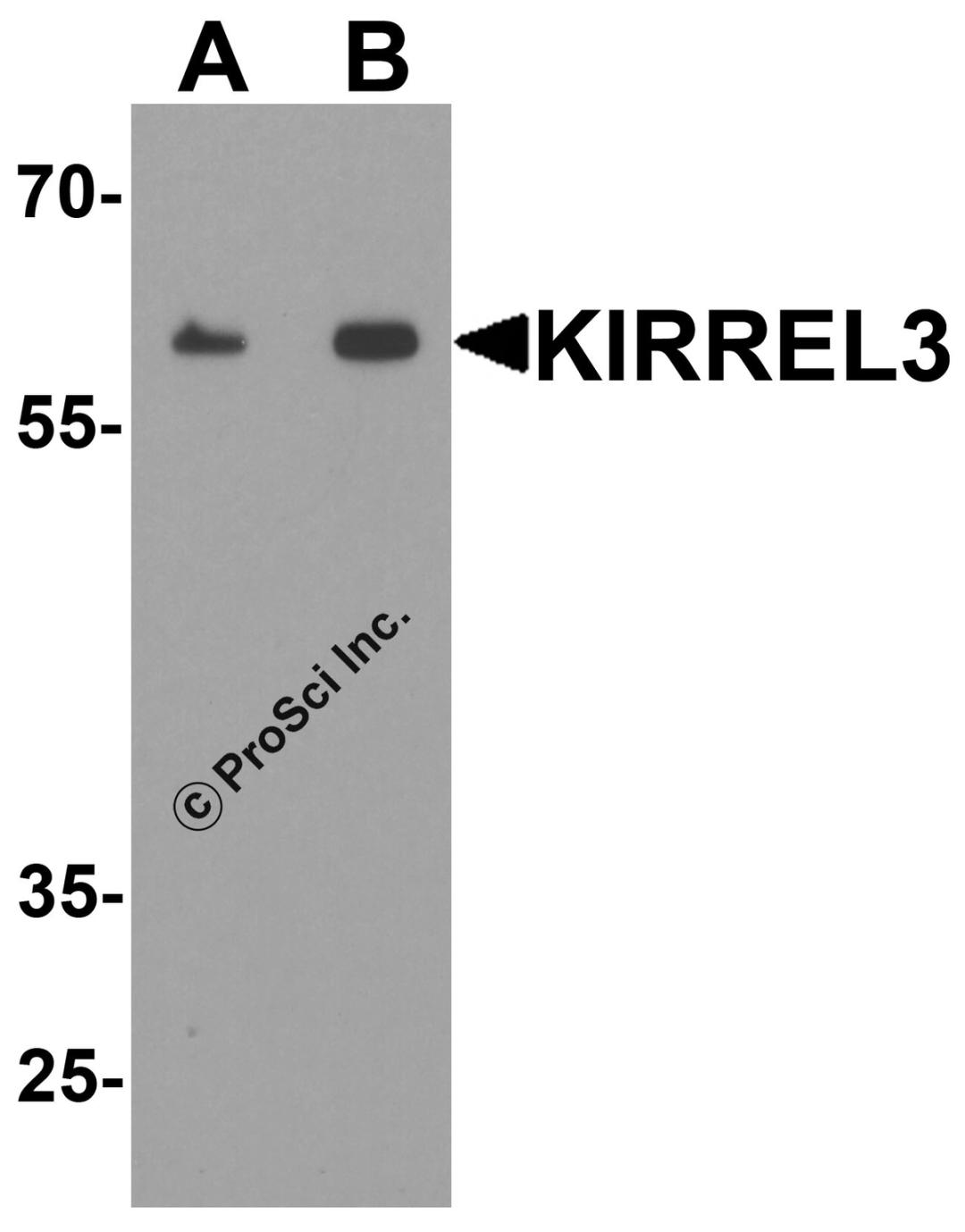 Western blot analysis of KIRREL3 in mouse kidney tissue lysate with KIRREL3 antibody at (A) 1 and (B) 2 μg/ml.