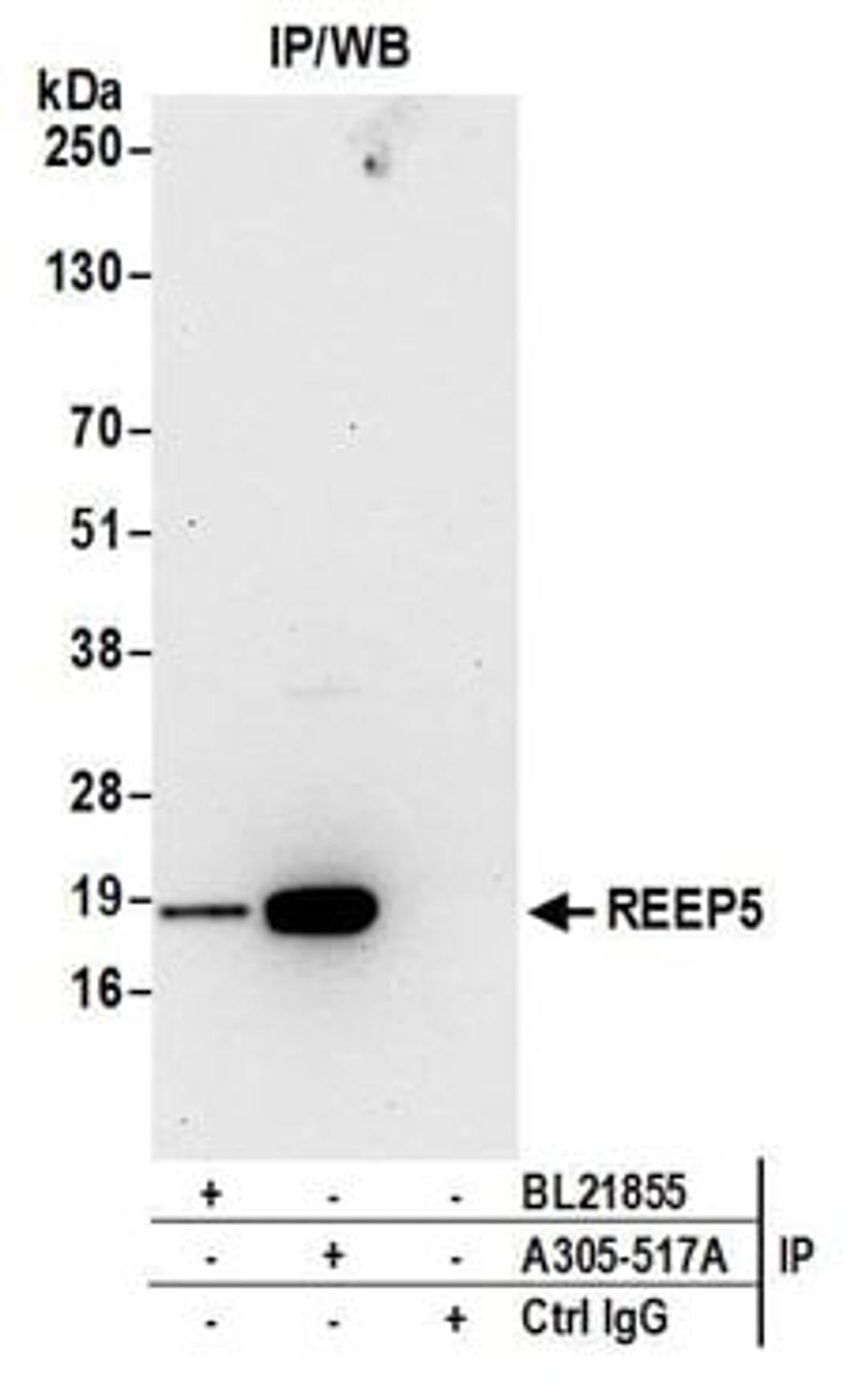 Detection of human REEP5 by western blot of immunoprecipitates.