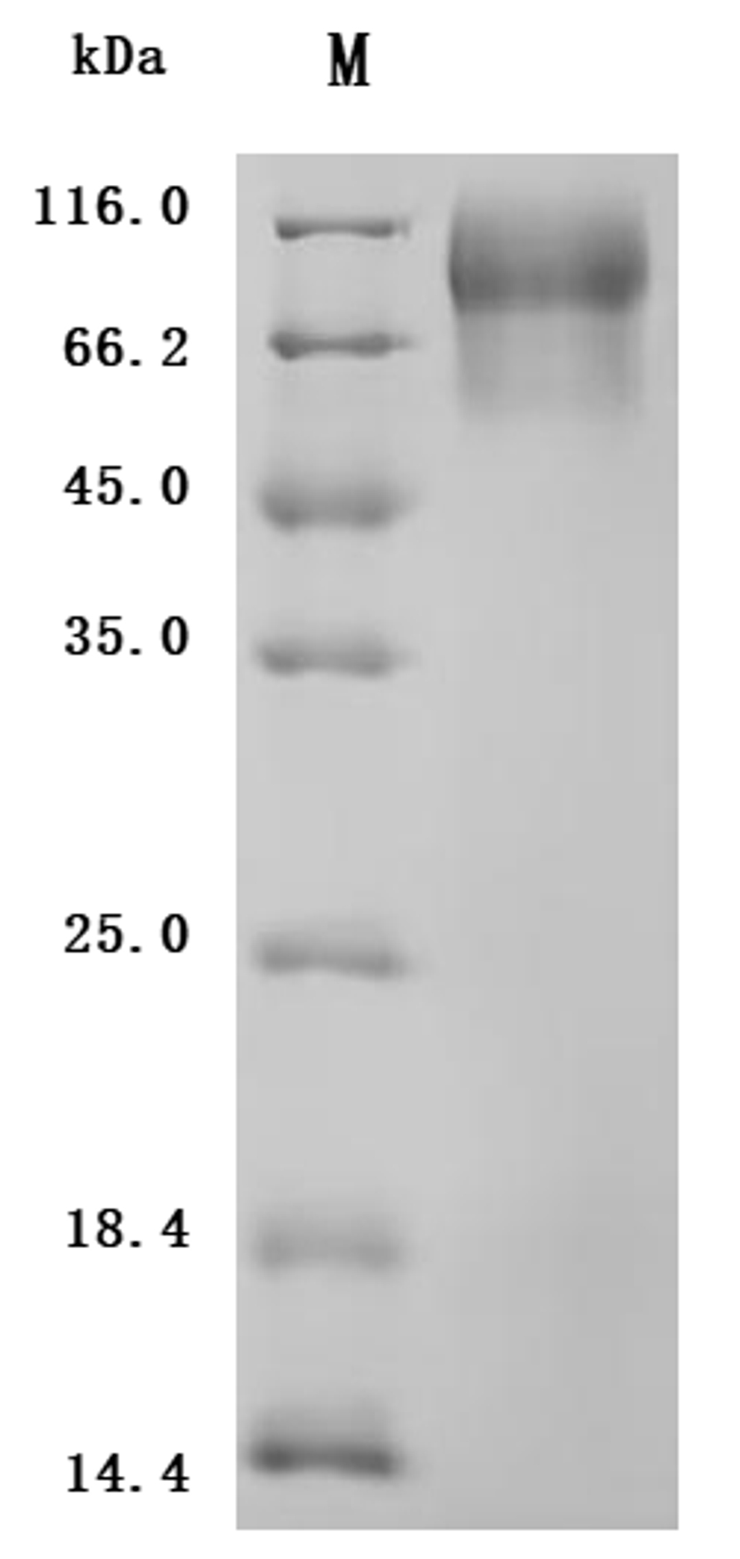 (Tris-Glycine gel) Discontinuous SDS-PAGE (reduced) with 5% enrichment gel and 15% separation gel.