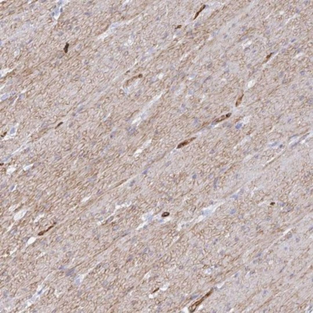 Immunohistochemistry: COX16 Antibody [NBP2-31863] - Immunohistochemical staining of human smooth muscle shows moderate cytoplasmic and membranous positivity in smooth muscle cells.