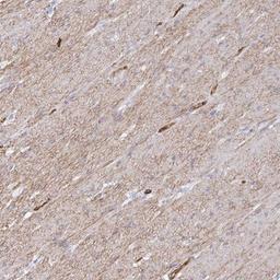 Immunohistochemistry: COX16 Antibody [NBP2-31863] - Immunohistochemical staining of human smooth muscle shows moderate cytoplasmic and membranous positivity in smooth muscle cells.