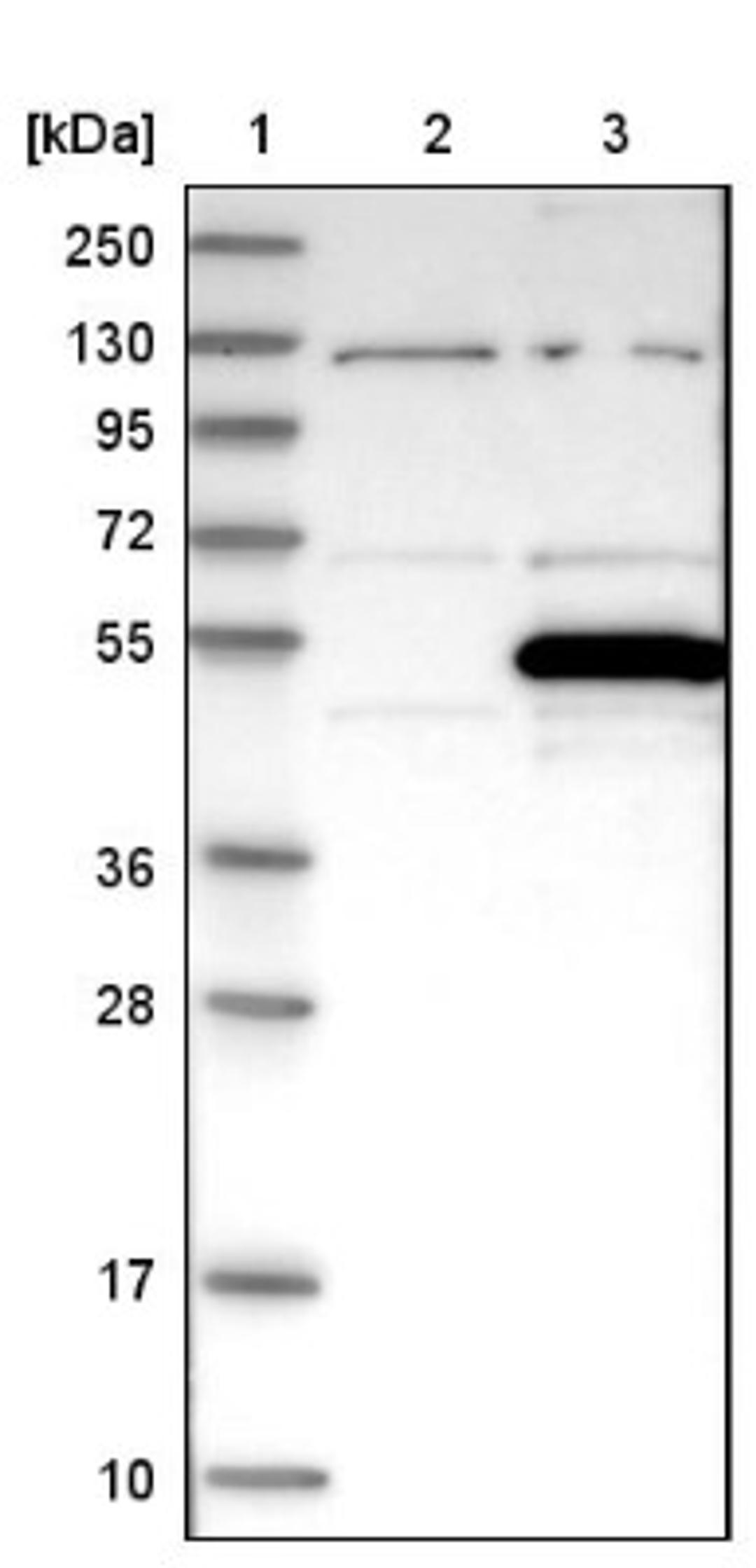 Western Blot: PREB Antibody [NBP1-87056] - Lane 1: Marker [kDa] 250, 130, 95, 72, 55, 36, 28, 17, 10<br/>Lane 2: Negative control (vector only transfected HEK293T lysate)<br/>Lane 3: Over-expression lysate (Co-expressed with a C-terminal myc-DDK tag (~3.1 kDa) in mammalian HEK293T cells, LY402254)