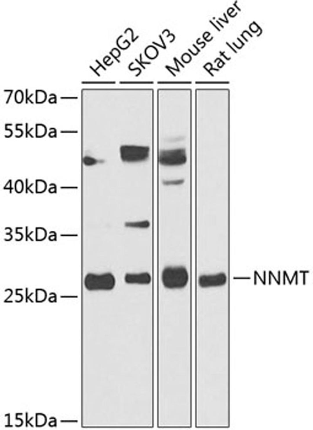 Western blot - NNMT antibody (A14030)