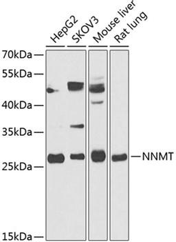 Western blot - NNMT antibody (A14030)