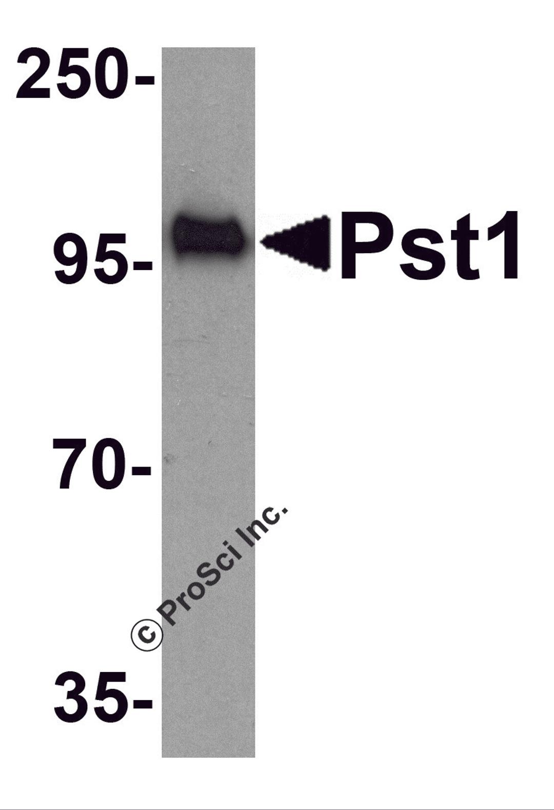 Western blot analysis of TM yeast Pst1 protein (50 ng) with Pst1 antibody at 1 μg/mL.