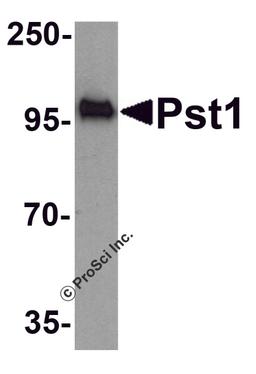 Western blot analysis of TM yeast Pst1 protein (50 ng) with Pst1 antibody at 1 μg/mL.
