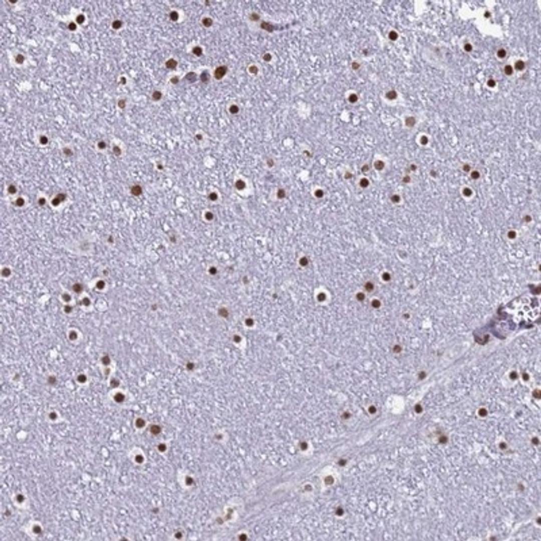 Immunohistochemistry-Paraffin: LCE6A Antibody [NBP1-94116] - Staining of human lateral ventricle shows strong nuclear positivity in glial cells.