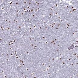 Immunohistochemistry-Paraffin: LCE6A Antibody [NBP1-94116] - Staining of human lateral ventricle shows strong nuclear positivity in glial cells.