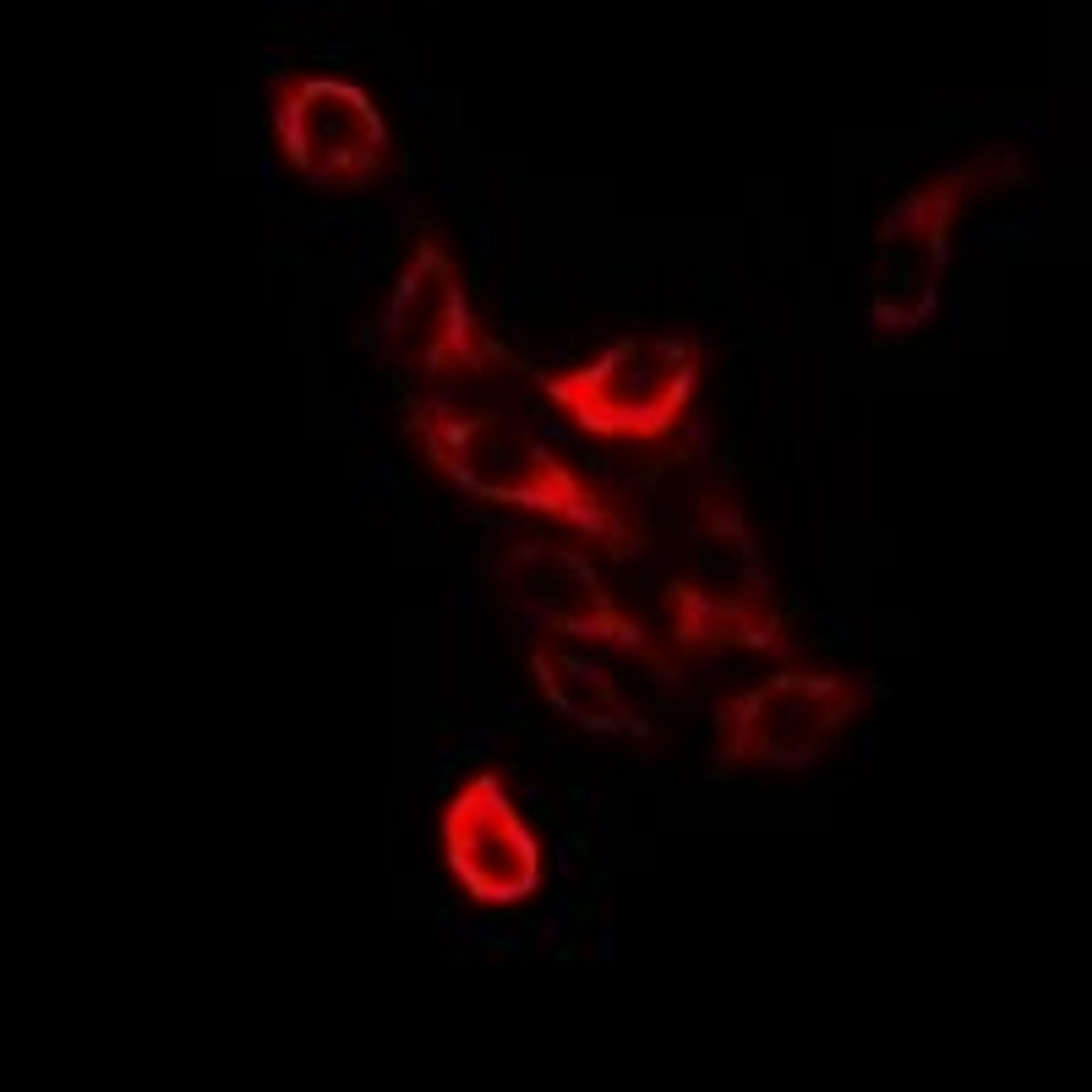 Immunofluorescense analysis of Jurkat cells using PTPN2 antibody