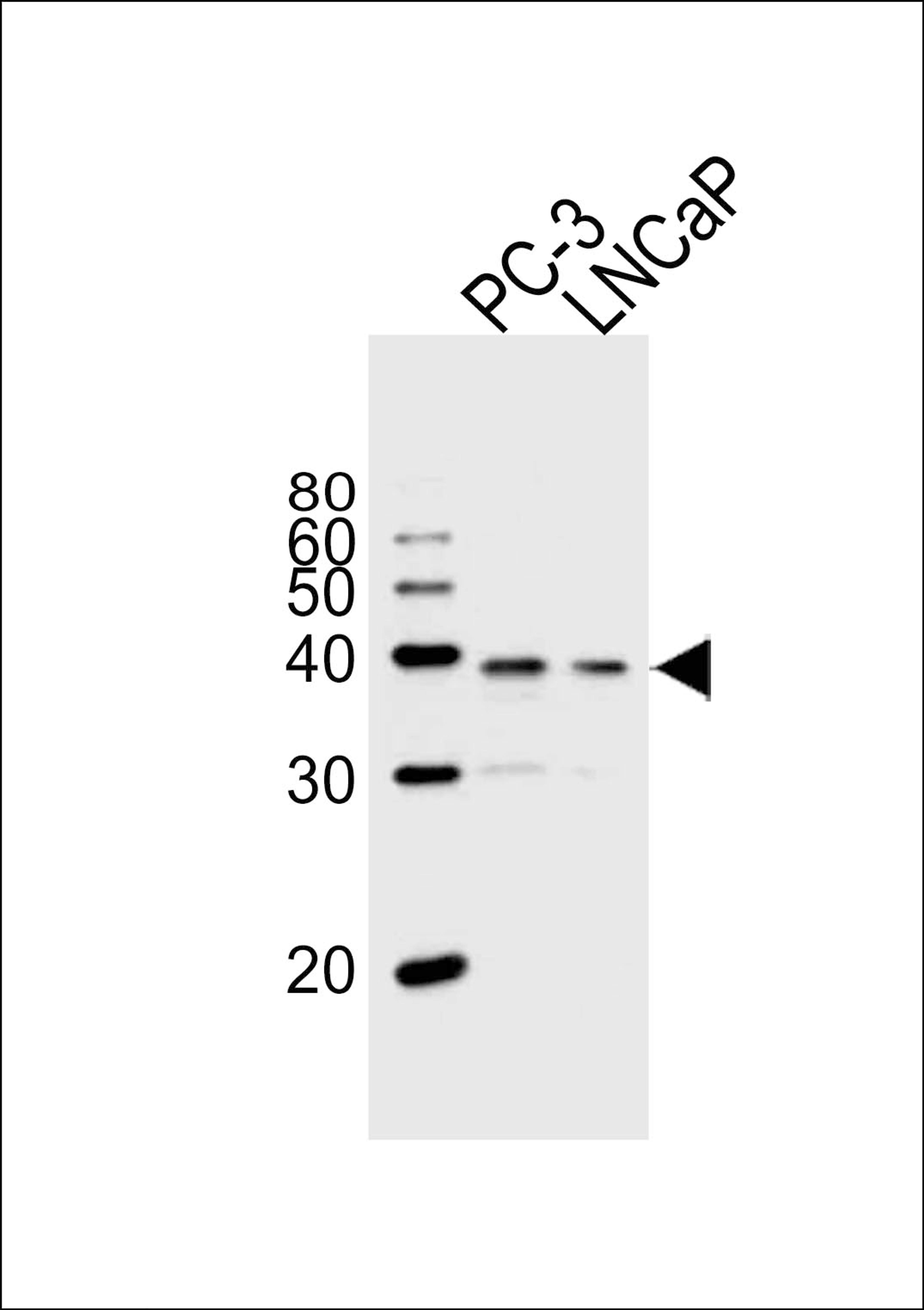 Western blot analysis of lysates from PC-3, LNCaP cell line (from left to right), using VDR Antibody at 1:1000 at each lane.