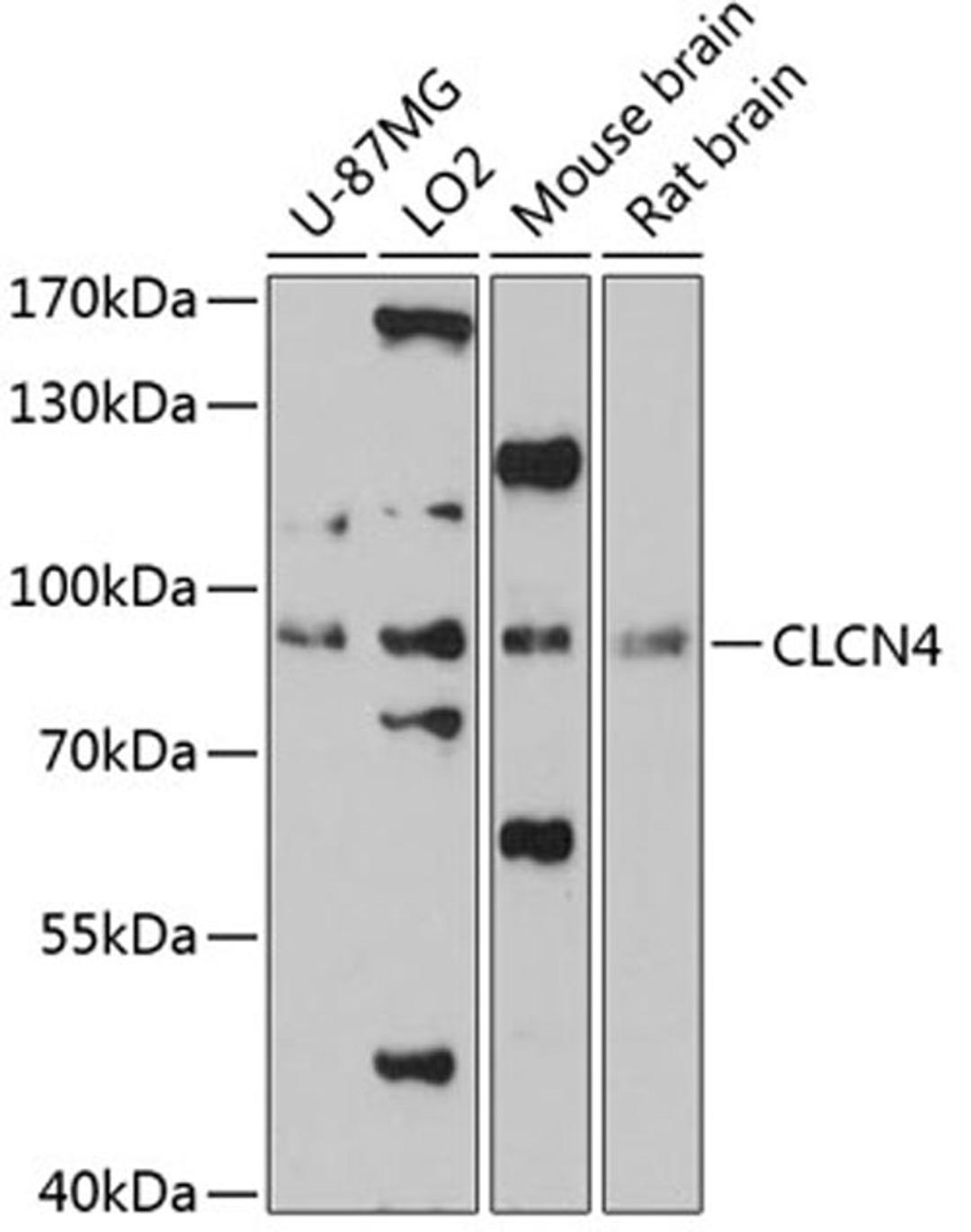 Western blot - CLCN4 antibody (A13790)