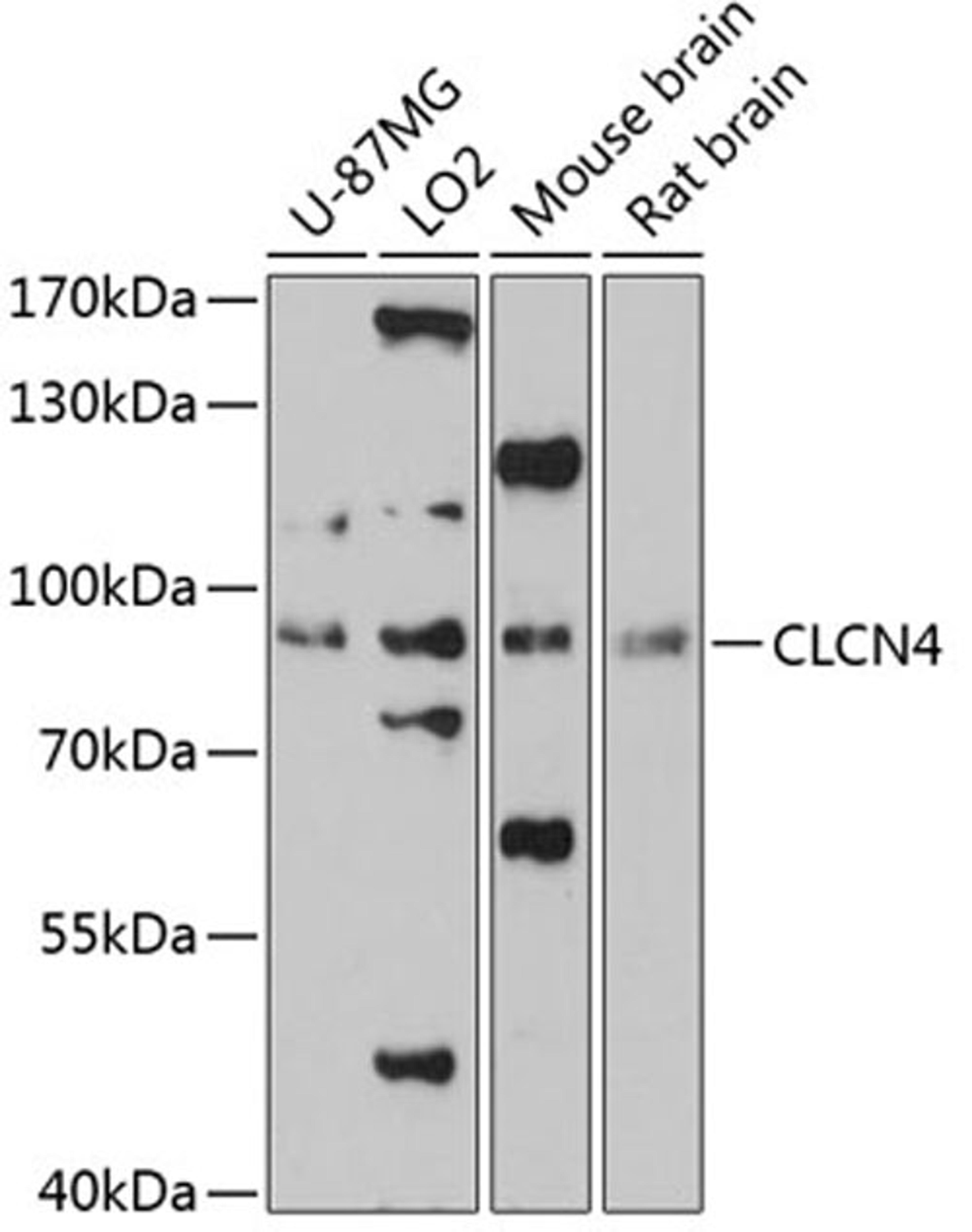 Western blot - CLCN4 antibody (A13790)