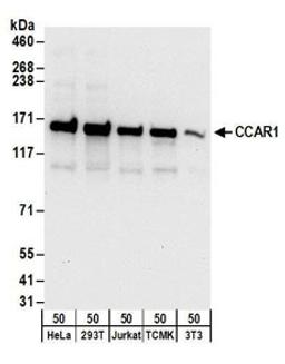 Detection of human and mouse CCAR1 by western blot.