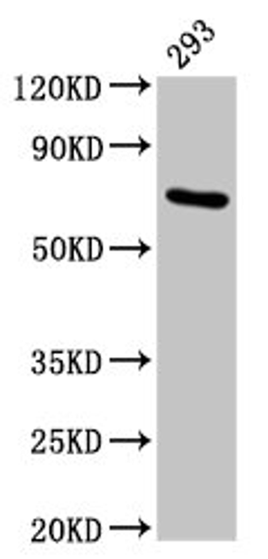 Western Blot. Positive WB detected in: 293 whole cell lysate. All lanes: HSPA1A antibody at 4.9µg/ml. Secondary. Goat polyclonal to rabbit IgG at 1/50000 dilution. Predicted band size: 71, 64 kDa. Observed band size: 71 kDa