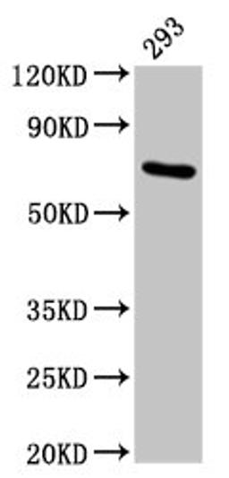 Western Blot. Positive WB detected in: 293 whole cell lysate. All lanes: HSPA1A antibody at 4.9µg/ml. Secondary. Goat polyclonal to rabbit IgG at 1/50000 dilution. Predicted band size: 71, 64 kDa. Observed band size: 71 kDa