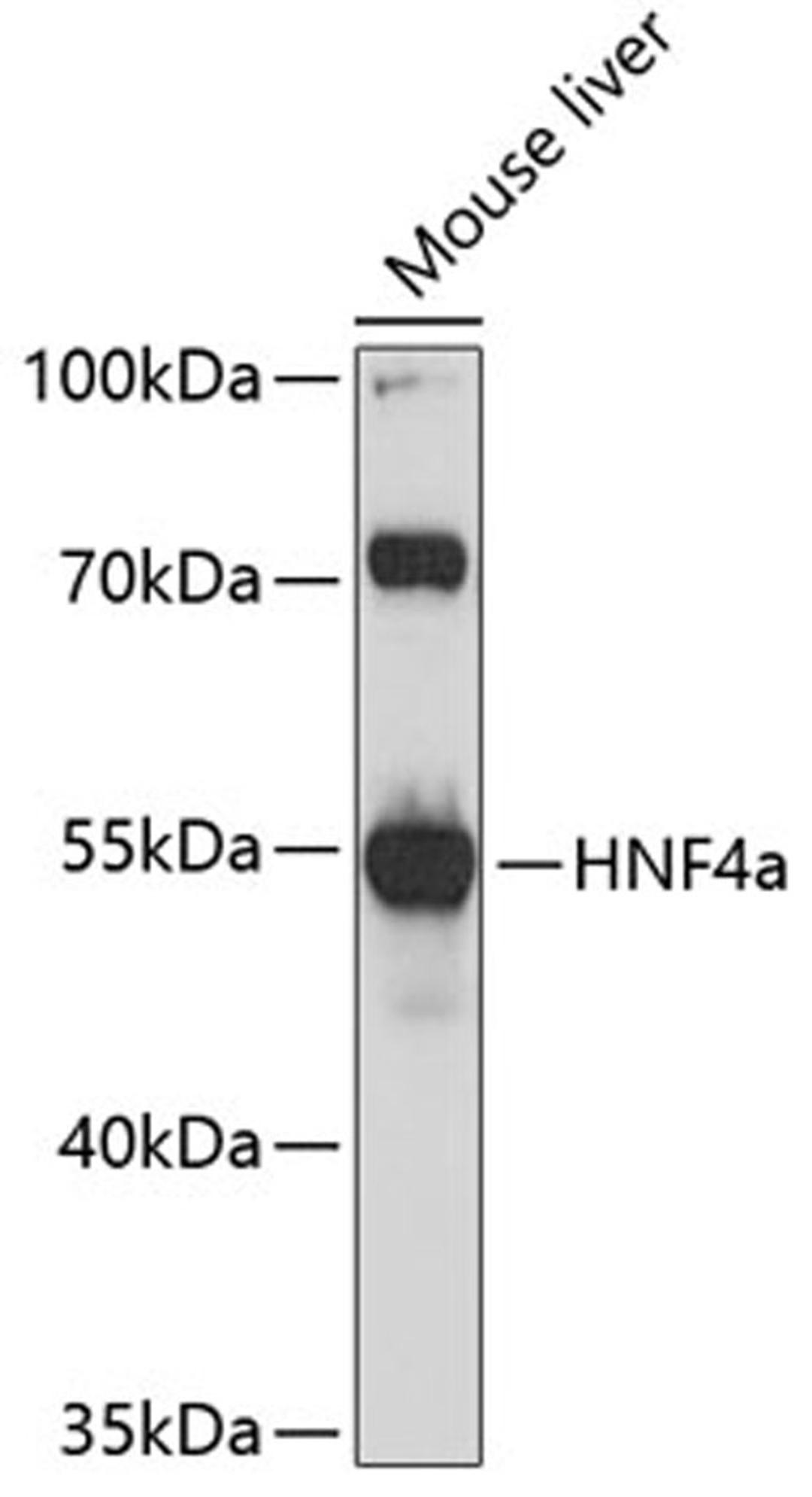 Western blot - HNF4a antibody (A11496)