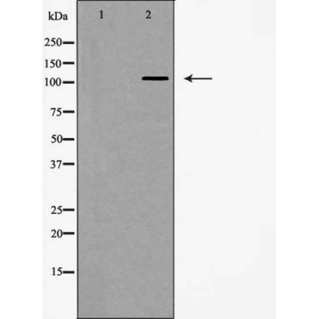 Western blot analysis of HeLa cells using Integrin Alpha5 (CD49e) antibody