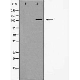 Western blot analysis of HeLa cells using Integrin Alpha5 (CD49e) antibody