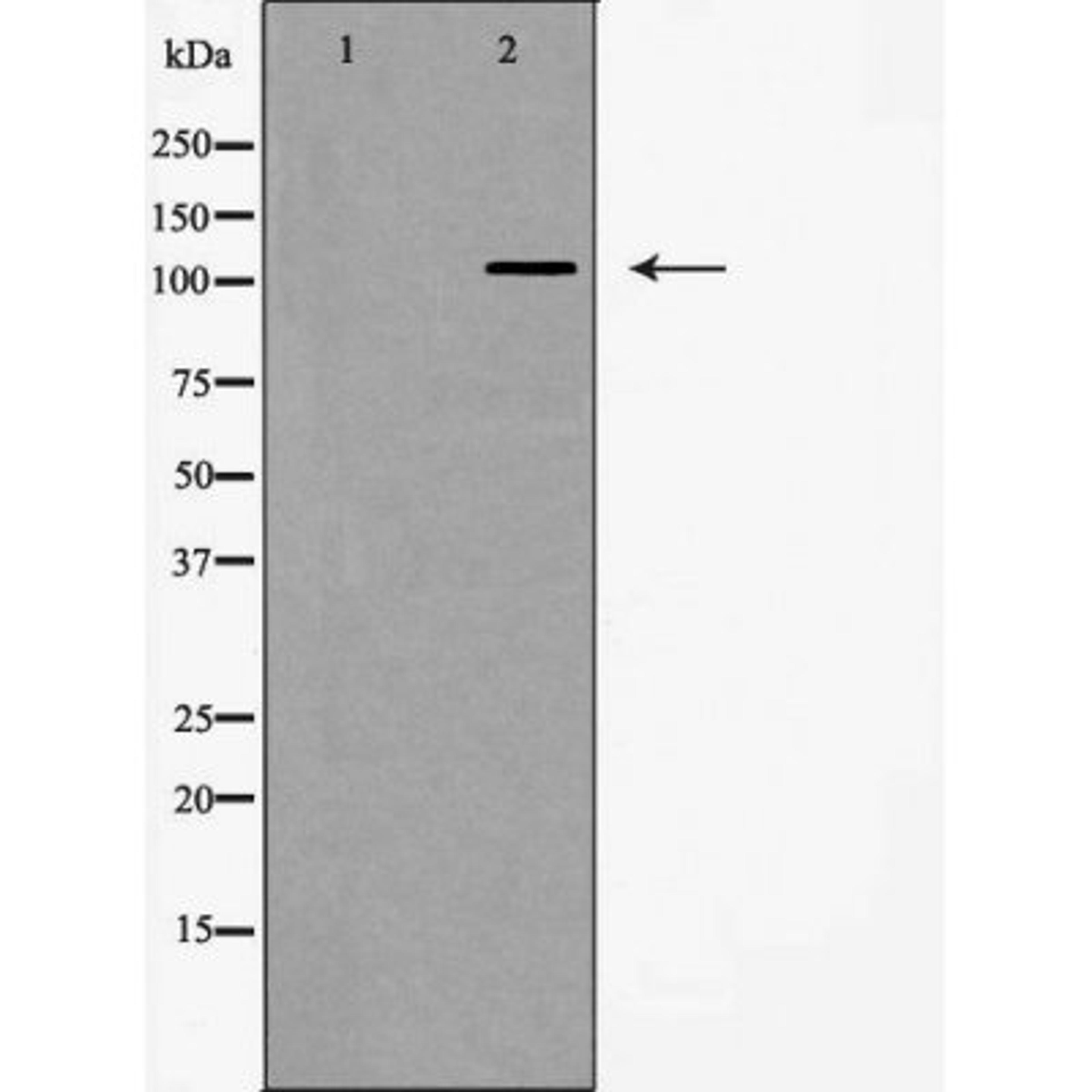 Western blot analysis of HeLa cells using Integrin Alpha5 (CD49e) antibody